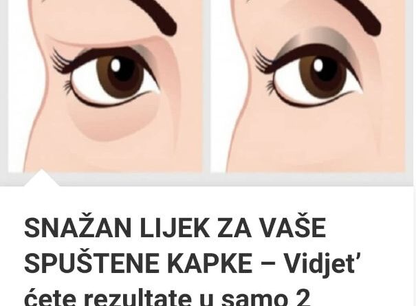 SNAŽAN LIJEK ZA VAŠE SPUŠTENE KAPKE – Vidjet’ Ćete Rezultate U Samo 2 Minute!